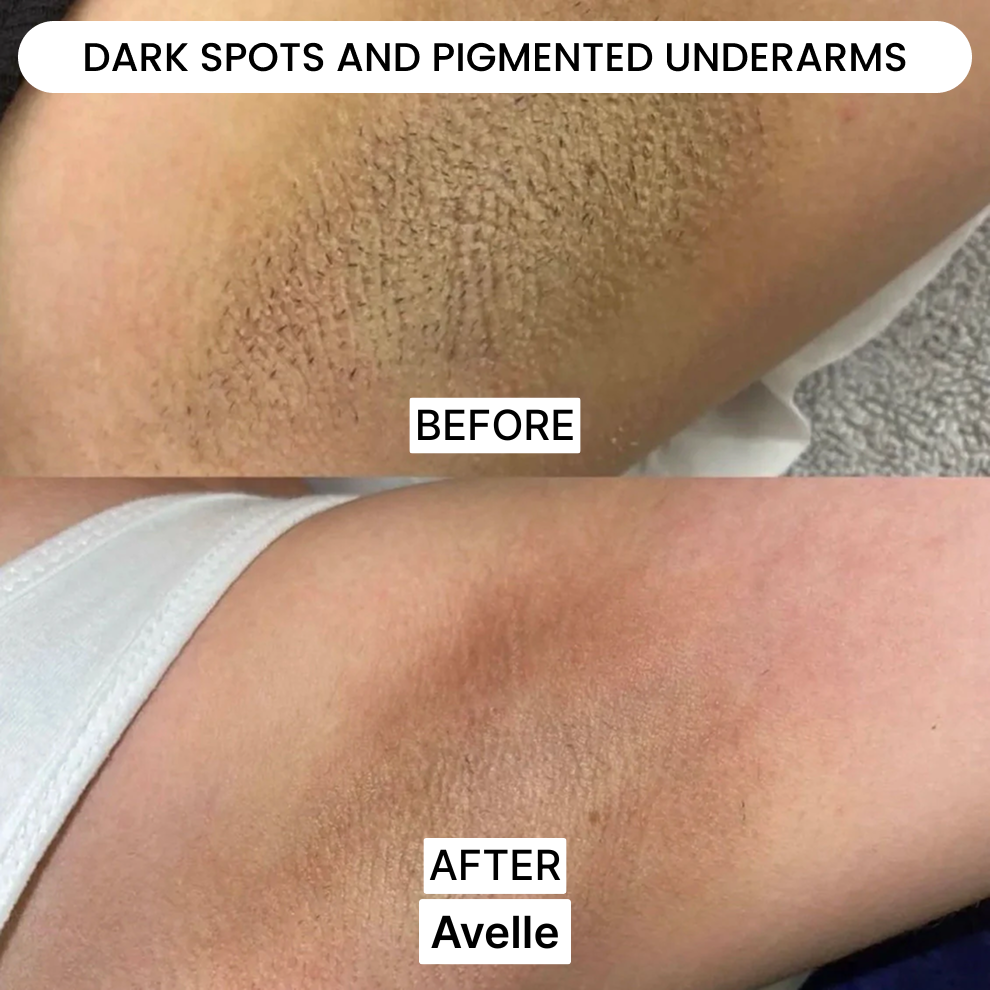 Avelle Shaver