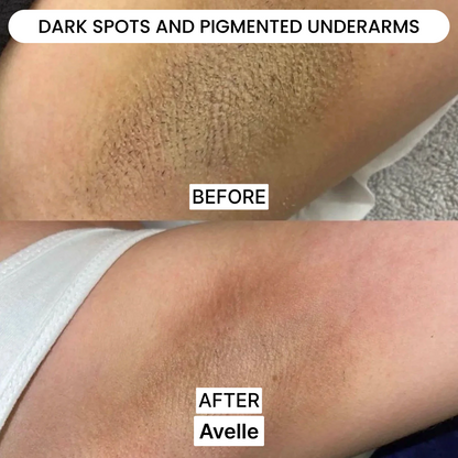 Avelle Shaver