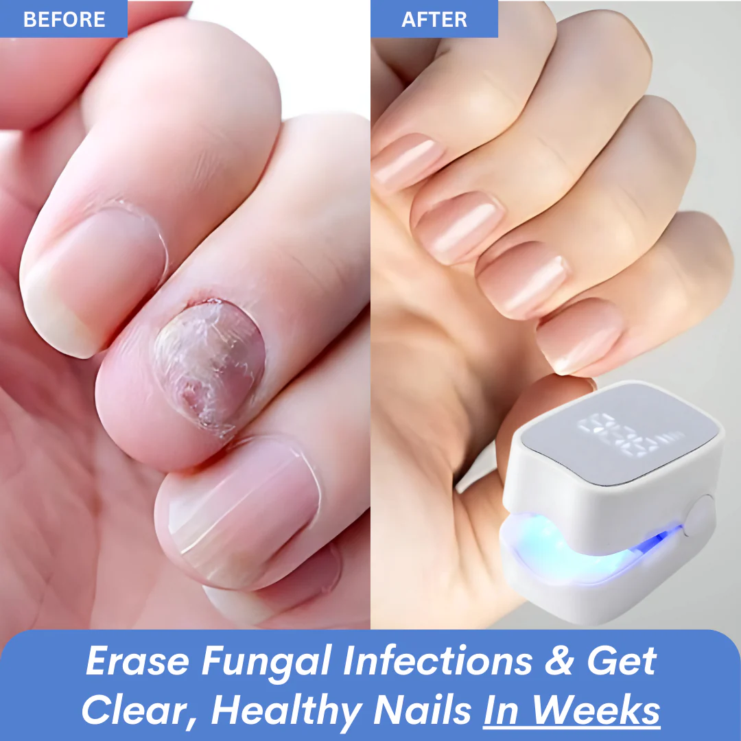ClearNail Pro